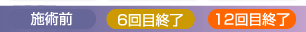 モンテセラピーの施術記録4